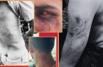 ماجرای حمله به گردشگران در اوپرت با سلاح گرم و شوکر چیست؟