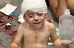 نیروی هوایی اسرائیل، بیمارستانی در شهر غزه را بمباران کرد / منابع غیر رسمی: بیش از هزار نفر کشته شدند