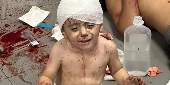 نیروی هوایی اسرائیل، بیمارستانی در شهر غزه را بمباران کرد / منابع غیر رسمی: بیش از هزار نفر کشته شدند
