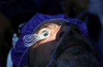 فاجعه کور شدن ۹ شهروند؛ متخلفان مجازات خواهند شد؟ فاجعه کور شدن ۹ شهروند؛ متخلفان مجازات خواهند شد؟